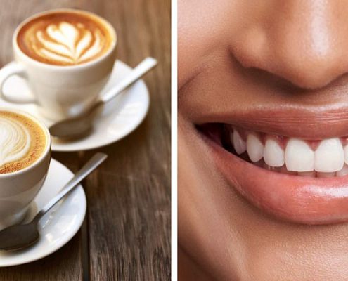 درمان لکه های قهوه روی دندان