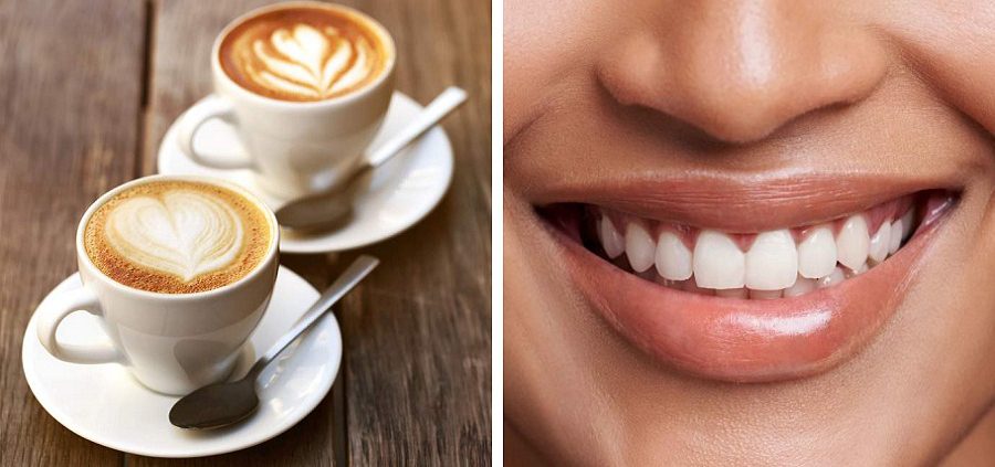 درمان لکه های قهوه روی دندان